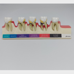 Parodontitis Studiemodel 